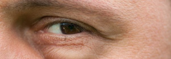 Three Signs of Aging that Can Be Reversed with Blepharoplasty